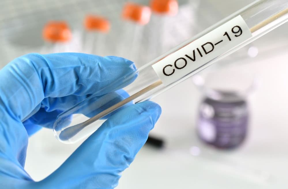 Κορωνοϊός: Ακριβαίνουν self test, rapid test και PCR