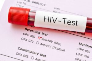 hiv aids test