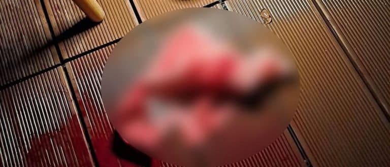 Χαλκιδική: Από μια παρεξήγηση ξεκίνησαν τα μαχαιρώματα και οι πυροβολισμοί