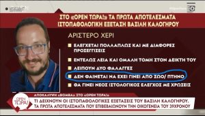 Αποκάλυψη – βόμβα για τον Β. Καλογήρου – Τι δείχνουν τα πρώτα αποτελέσματα των ιστοπαθολογικών