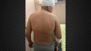 Ξυλοδαρμός 13χρονου στις Συκιές: Ελεύθερος με αναμορφωτικά μέτρα ο 18χρονος