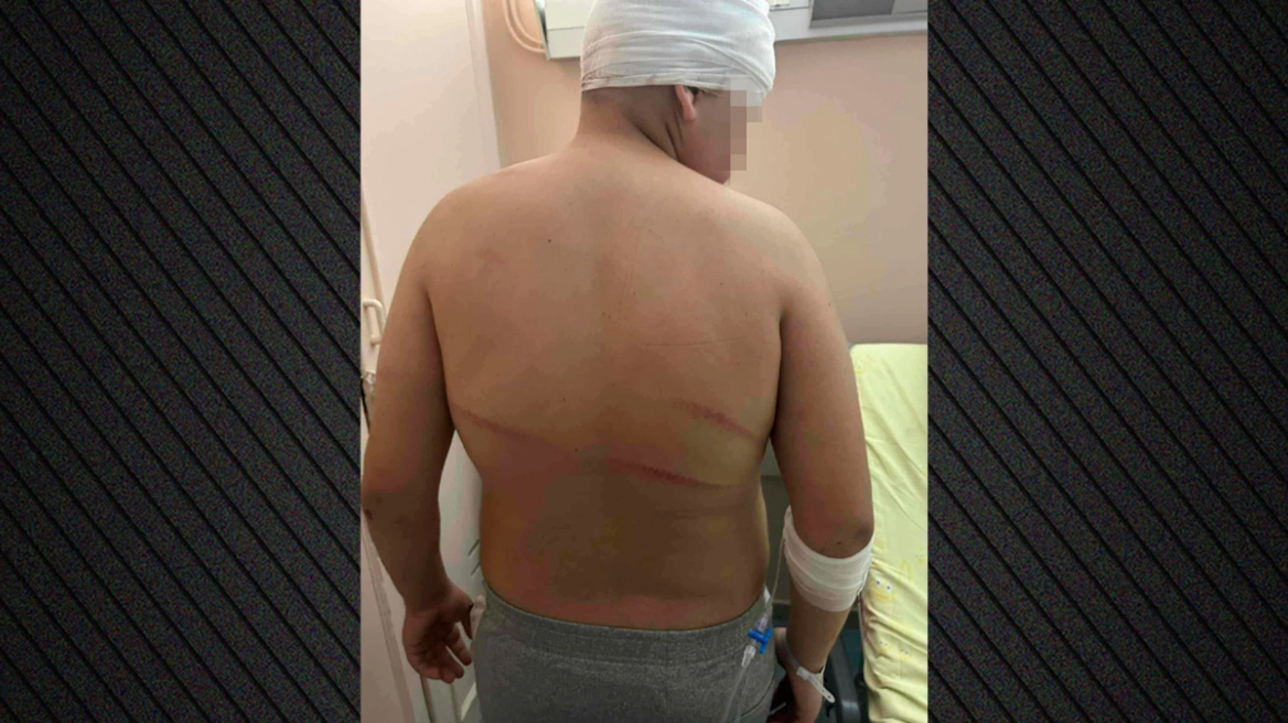 Ξυλοδαρμός 13χρονου στις Συκιές: Ελεύθερος με αναμορφωτικά μέτρα ο 18χρονος